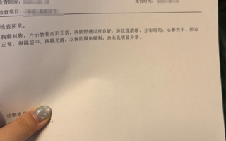 张掖找人代替抽血鸡西入职体检报告