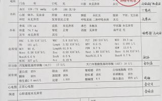 张掖找人代替抽血苏州工业园区入职体检